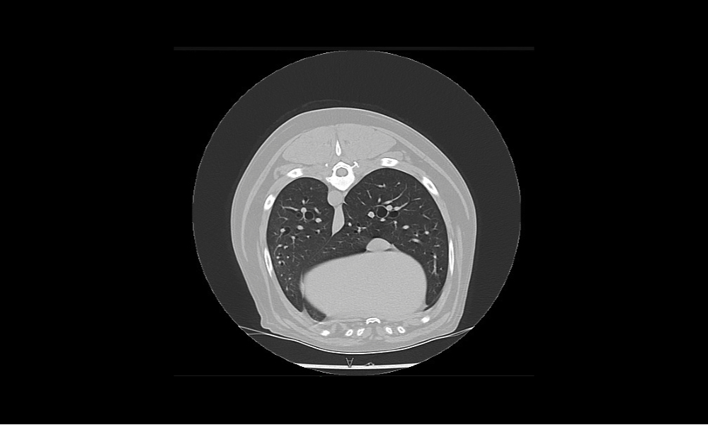CT scan of heart and lungs of a dog