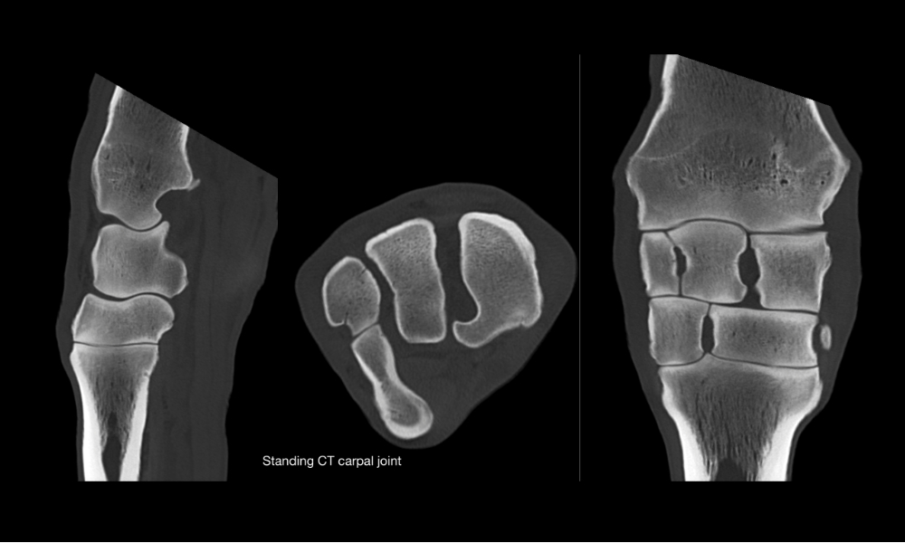Standing CT of a carpal joint