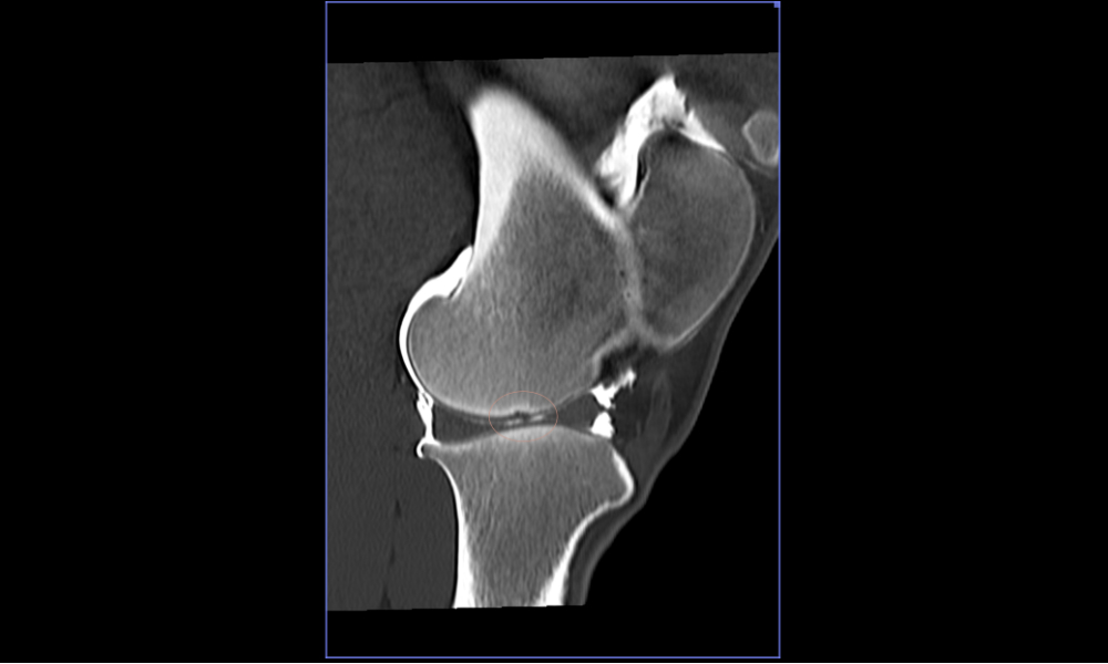 Arthrography of an equine stifle with a subchondral bone lesion showing contrast enhancement