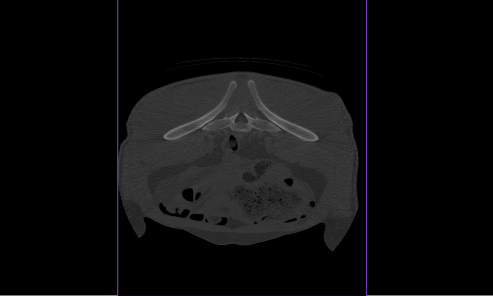 Sacroiliac joint and abdomen of an adult horse