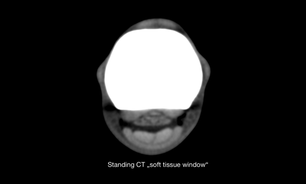 Soft tissue evaluation at the level of P1: SDFT, DDFT and sesamoid ligaments