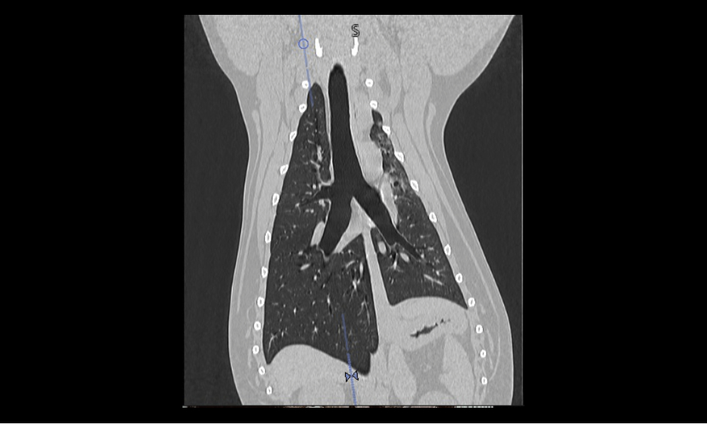 Thorax scan of a dog in the coronal plane