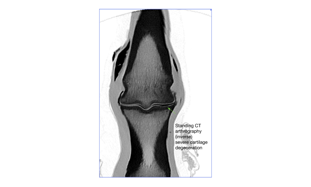 Inversed CT image of a standing arthrography in a fetlock joint showing joint cartilage degeneration