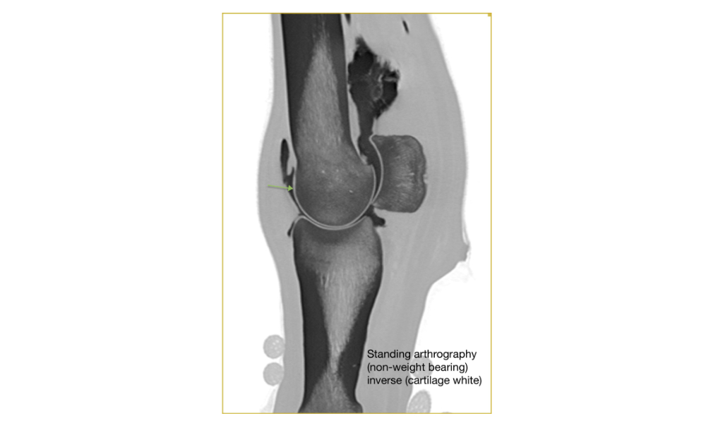 Inversed CT image of a fetlock arthrogram facilitates the demarcation of the articular cartilage