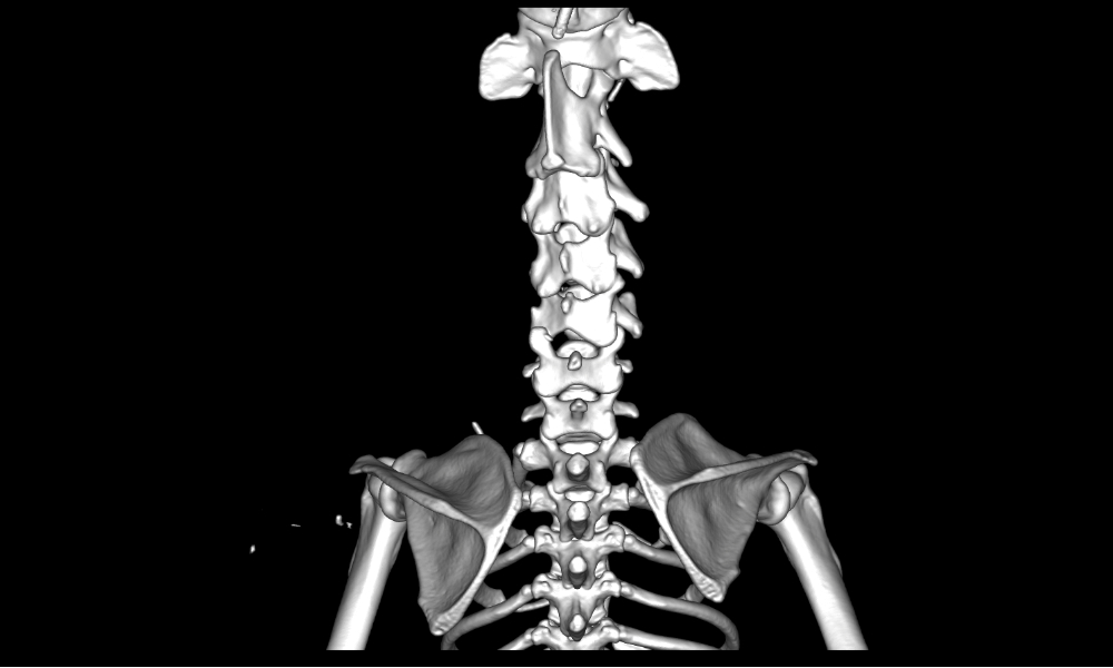 Neck scan of a dog in a 3D reconstruction