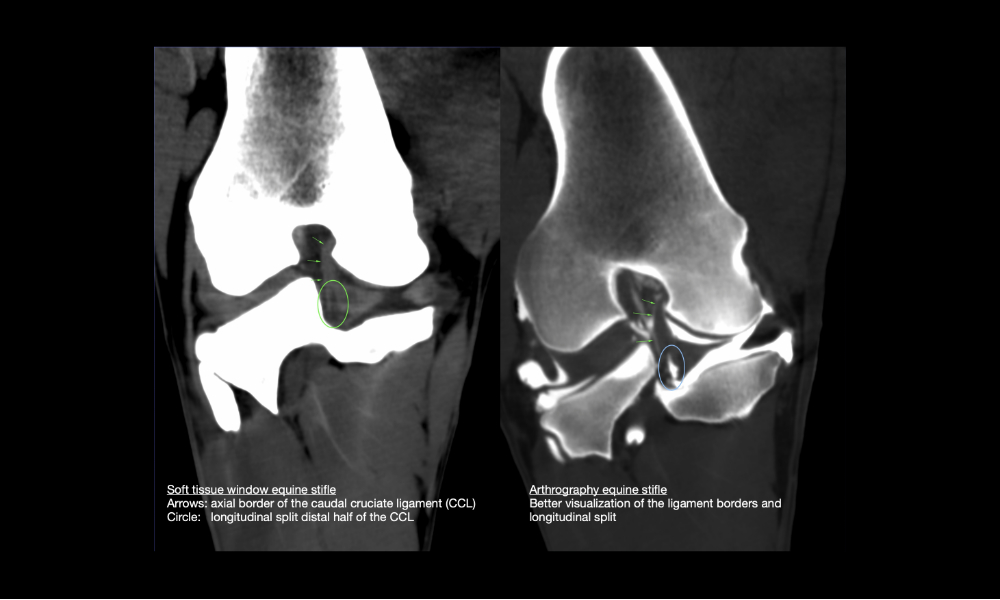 Comparative soft tissue window (L) and bone window after intraarticular contrast injection (R) of the same stifle showing severe lesions in the caudal cruciate ligament