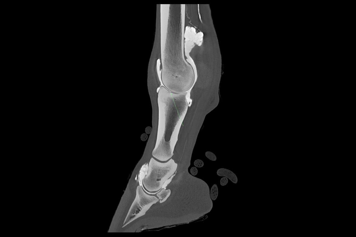 The contrast agent is embedded in the cartilage lesions of a fetlock joint