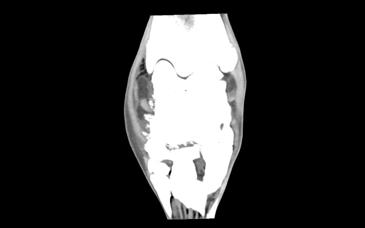 Severe desmopathy of the medial CL in a tarsus with obvious bone remodelling