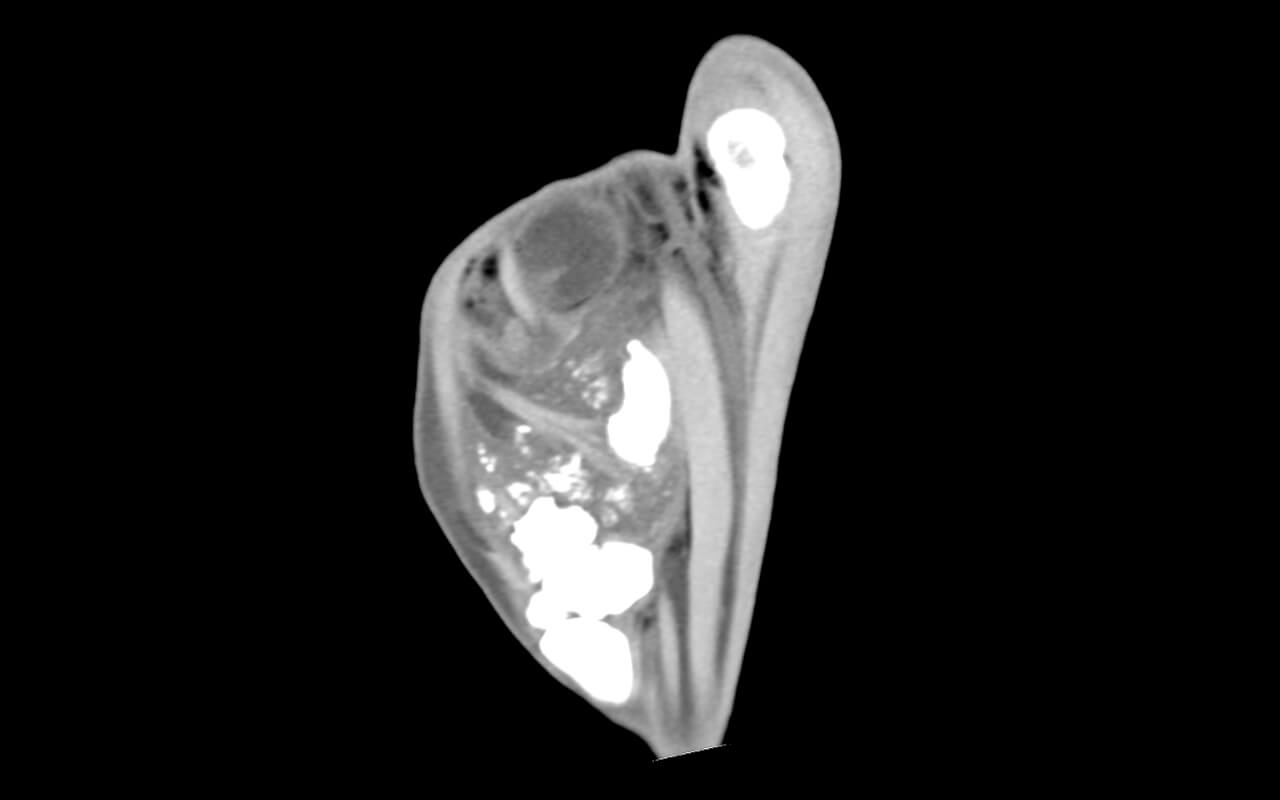 Standing CT of an equine hock shows severe enthesiopathy in the pars tibiocalcanea of the medial CL